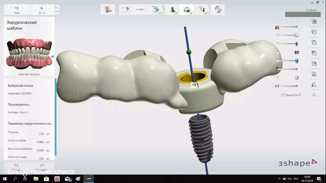 Фото моделювання шаблону з направляючою&nbsp;&nbsp;для установки імплантату Київ Бровари