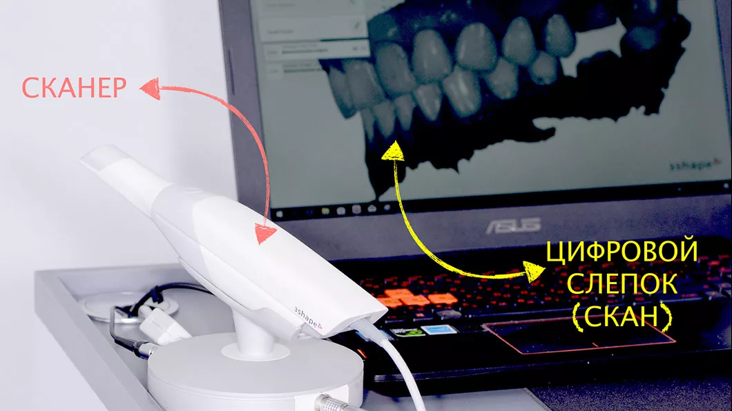 Цифрова стоматологія Бровари Київ Стоматологічна клініка Olanko dental studio Оланко