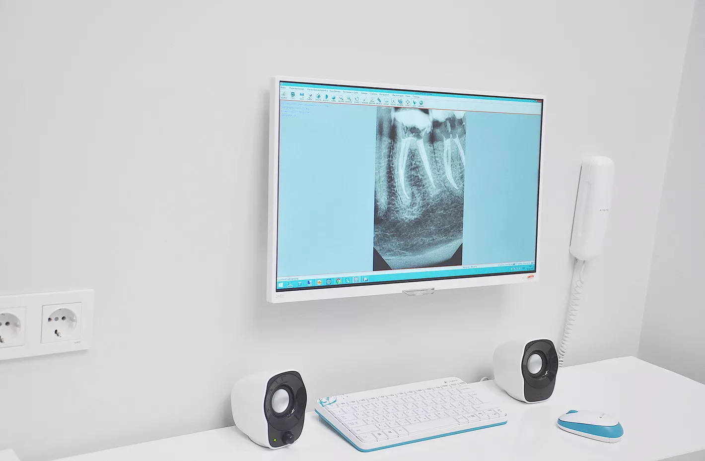 Дентальний рентген апарат Olanko Dental Studio Бровари Київ