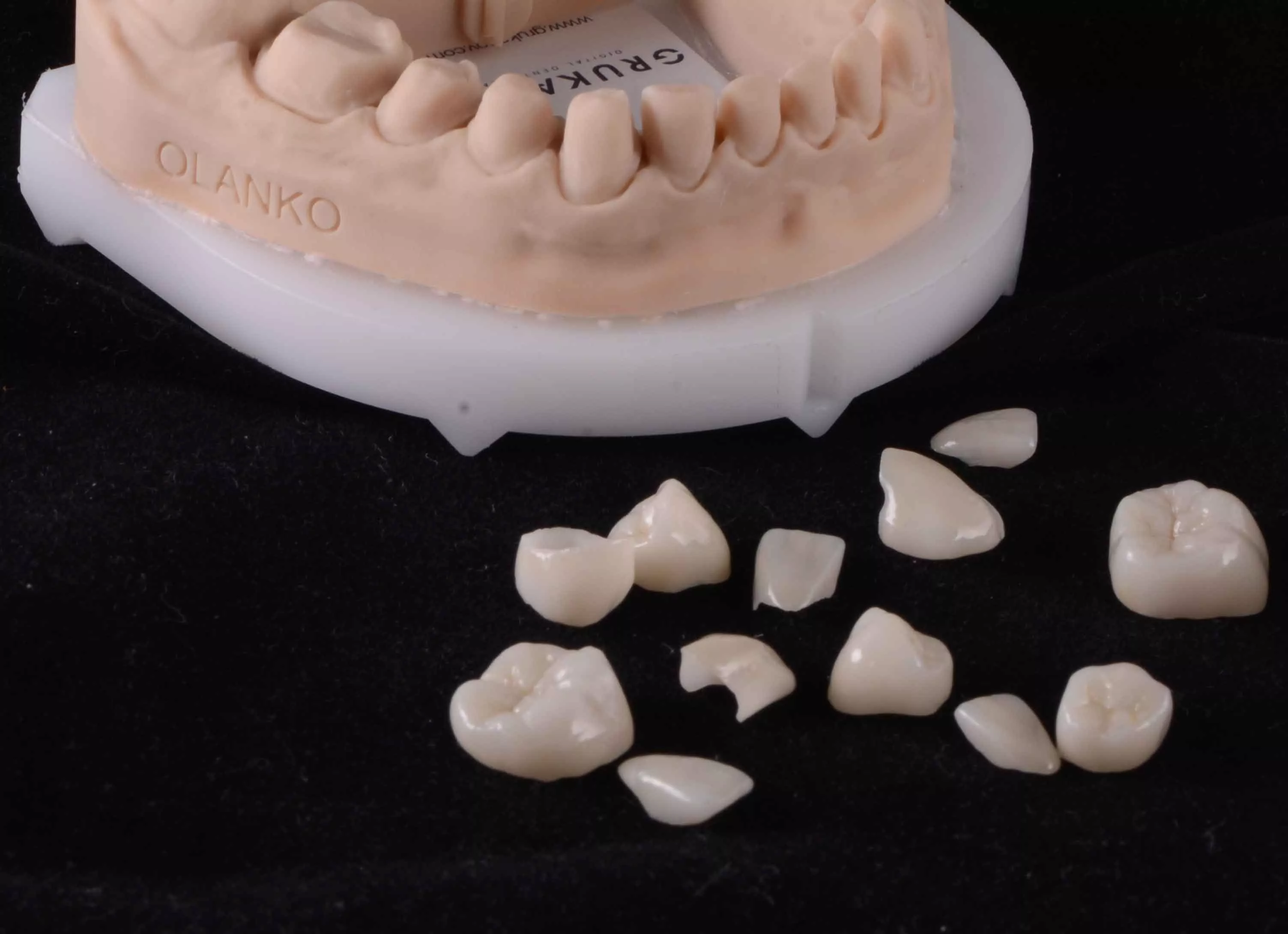 Керамічні вініри та коронки