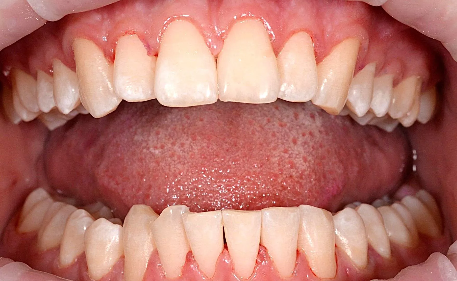 Професійний догляд за зубами та яснами