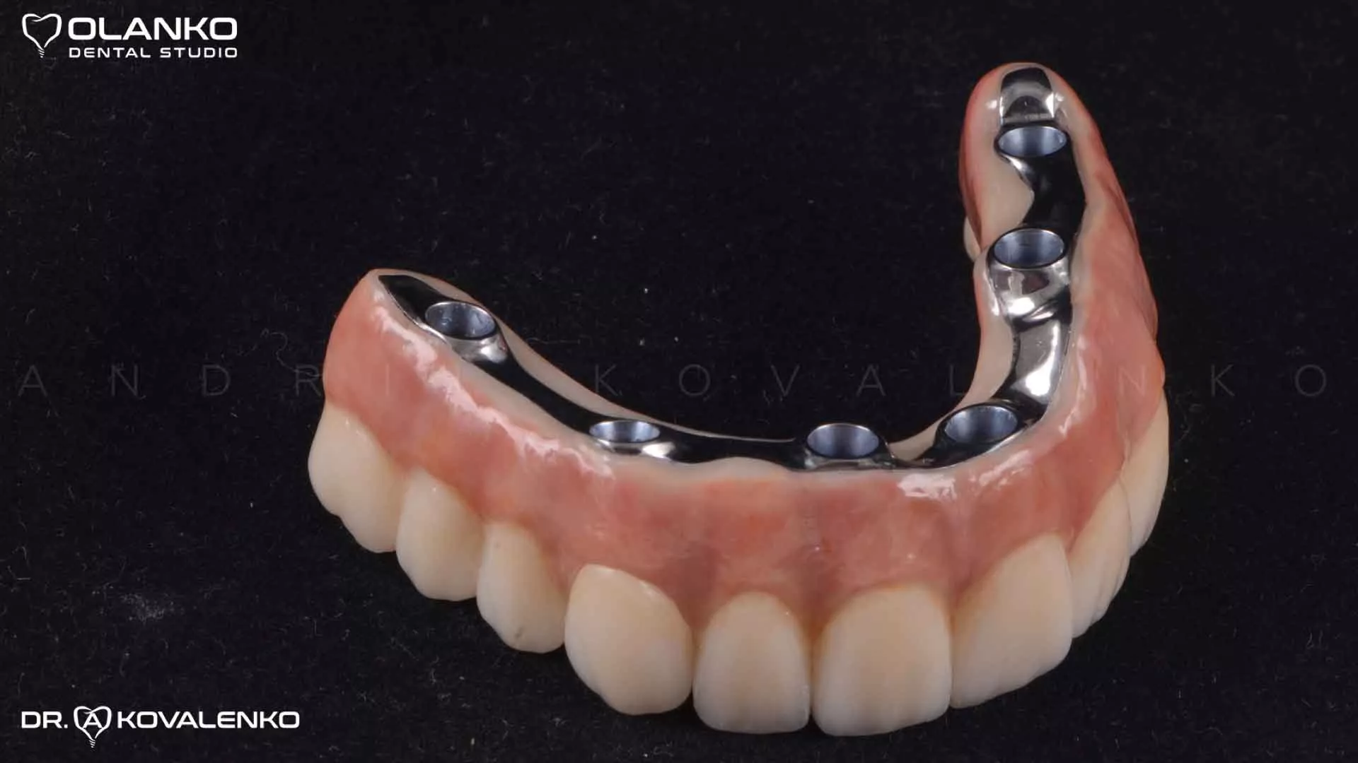 Клінічний випадок 7 імплантація