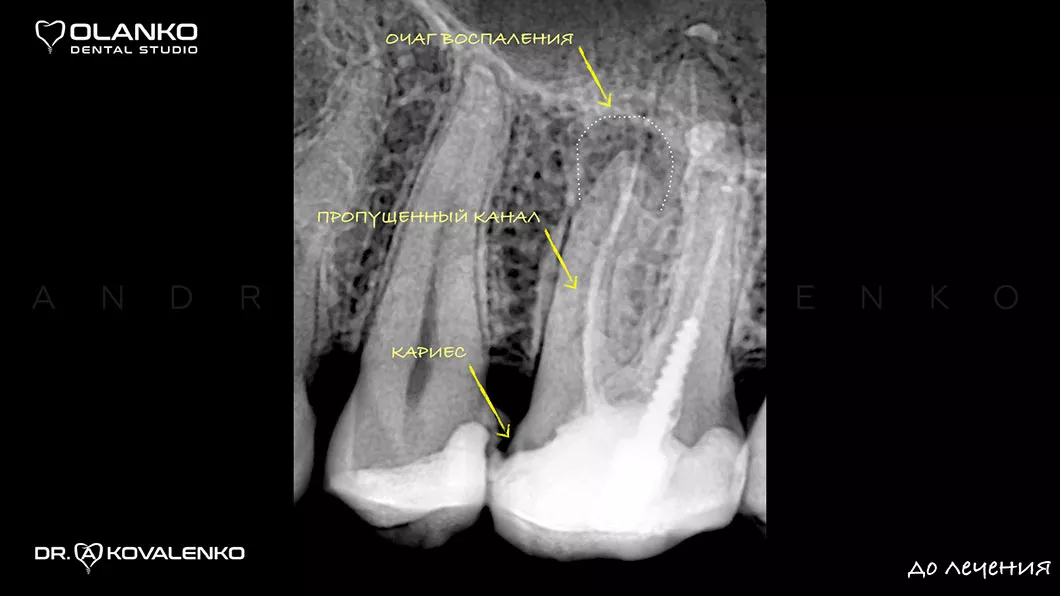 Рентген діагностика. Радіовізіографія та&nbsp;комп'ютерна томографія за потребою Київ Бровари