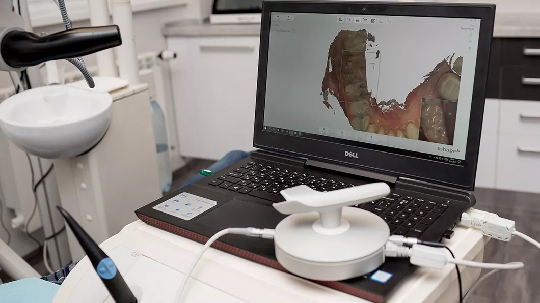 Внутрішньоротовий оптичний сканер 3Shape Olanko