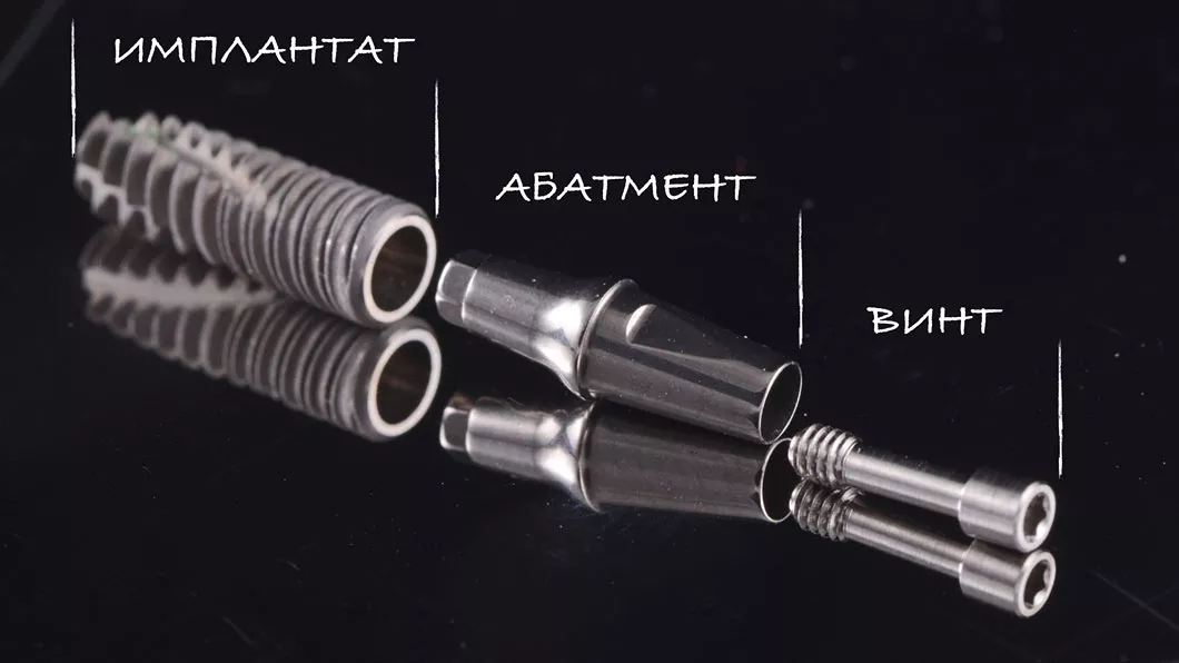 <p><strong>Імплантація зубів є одним з найсучасніш