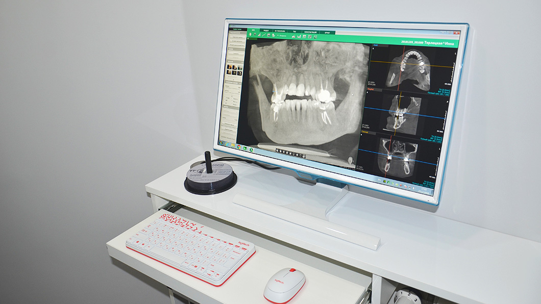 3D комп'ютерний томограф з цефалостатом Olanko Dental