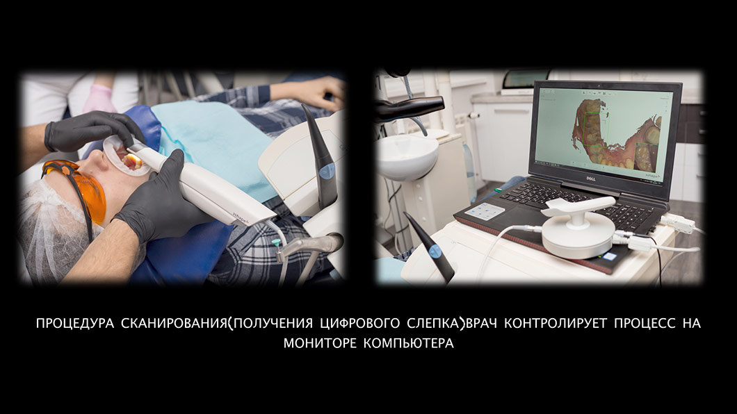Цифрова стоматологія методом CAD CAM Оланко Київ Бровари Україна