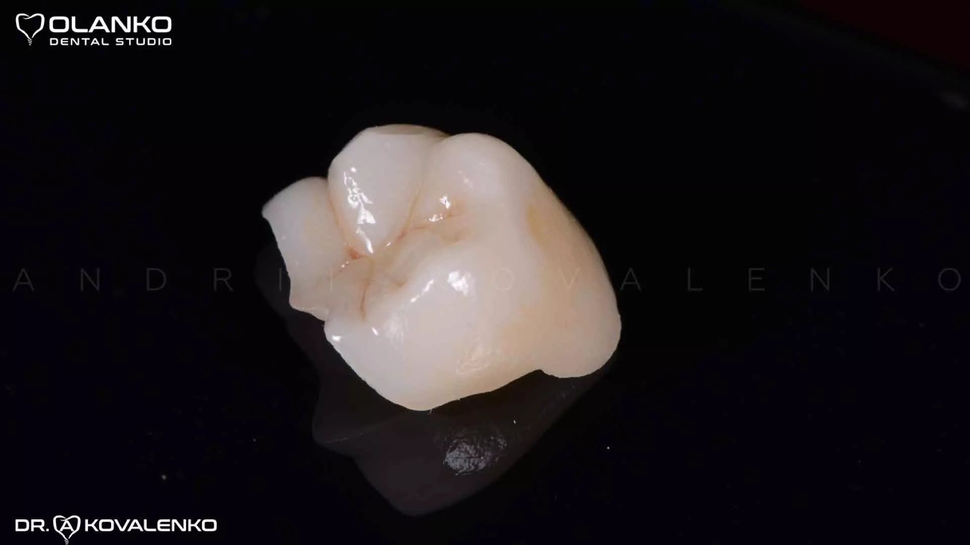 Керамическая вкладка