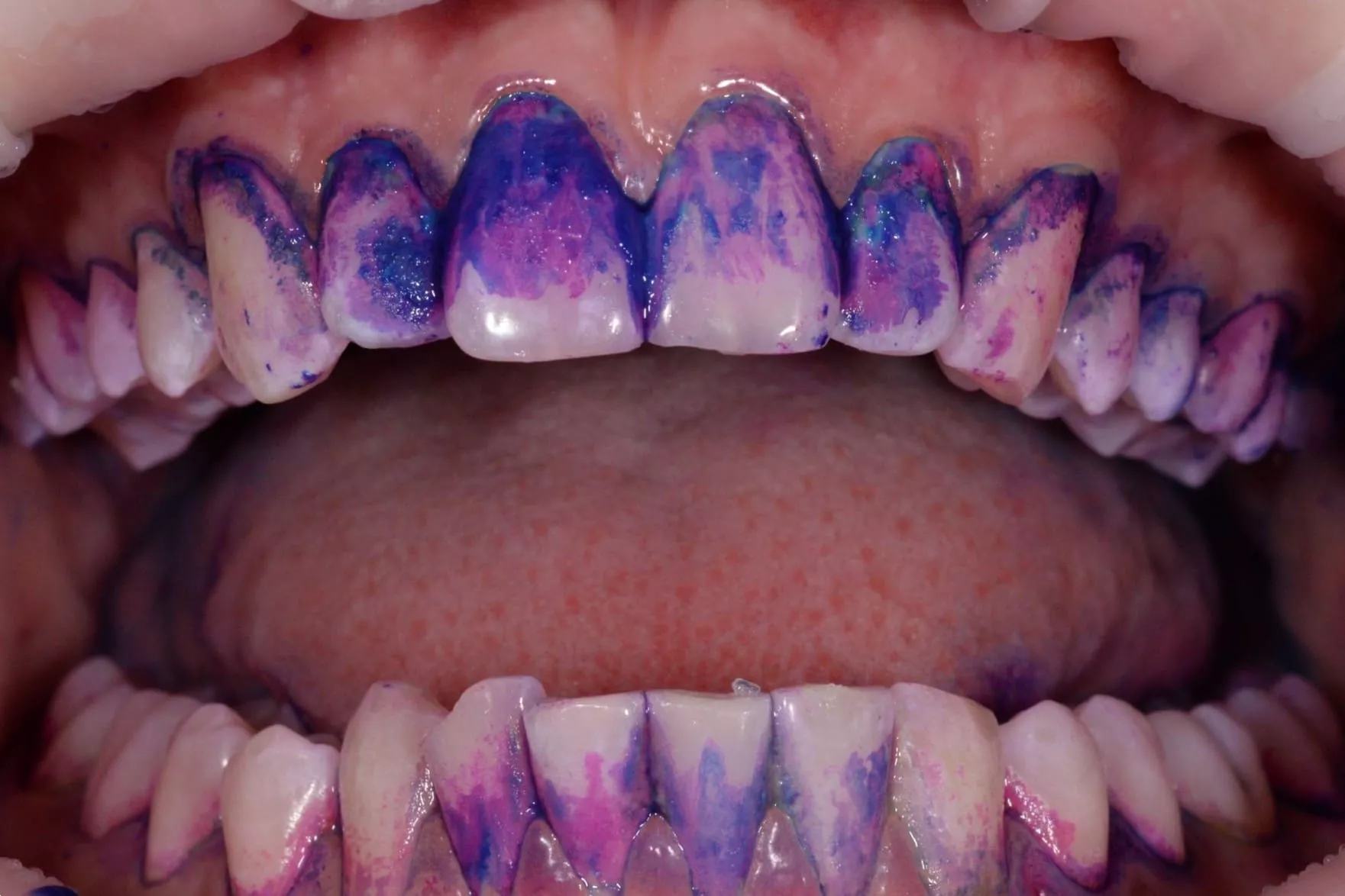 Профессиональный уход за зубами и дёснами