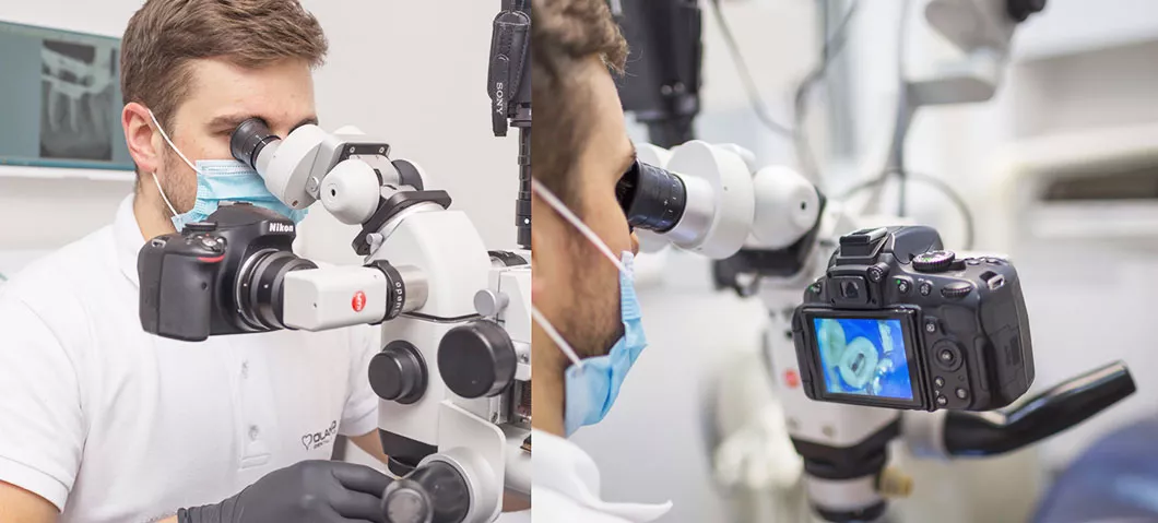 Лечение зубов под микроскопом, лечение каналов зуба цена Бровары Киев