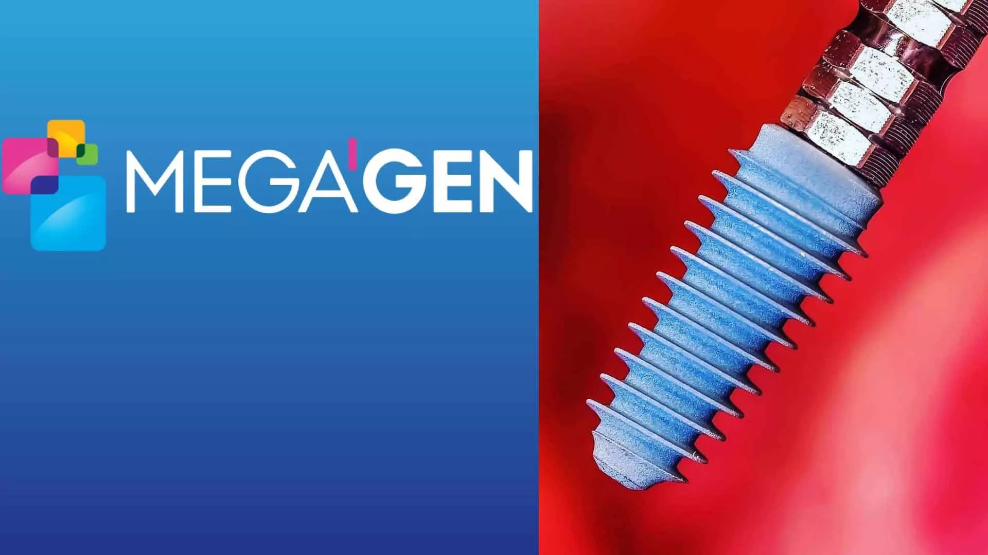 Преимущества имплантатов MegaGen Оланко Бровары Киев