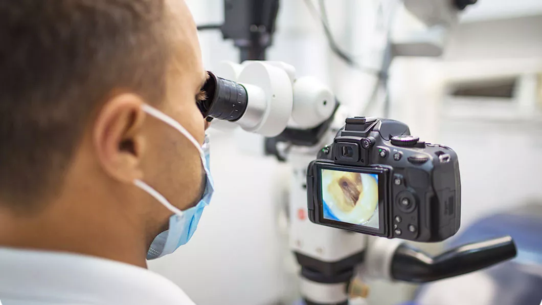 Лечение корневых каналов зуба с использованием микроскопа Киев Бровары