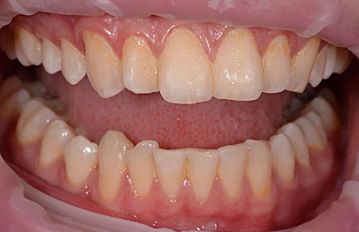 Профессиональный уход за зубами и дёснами