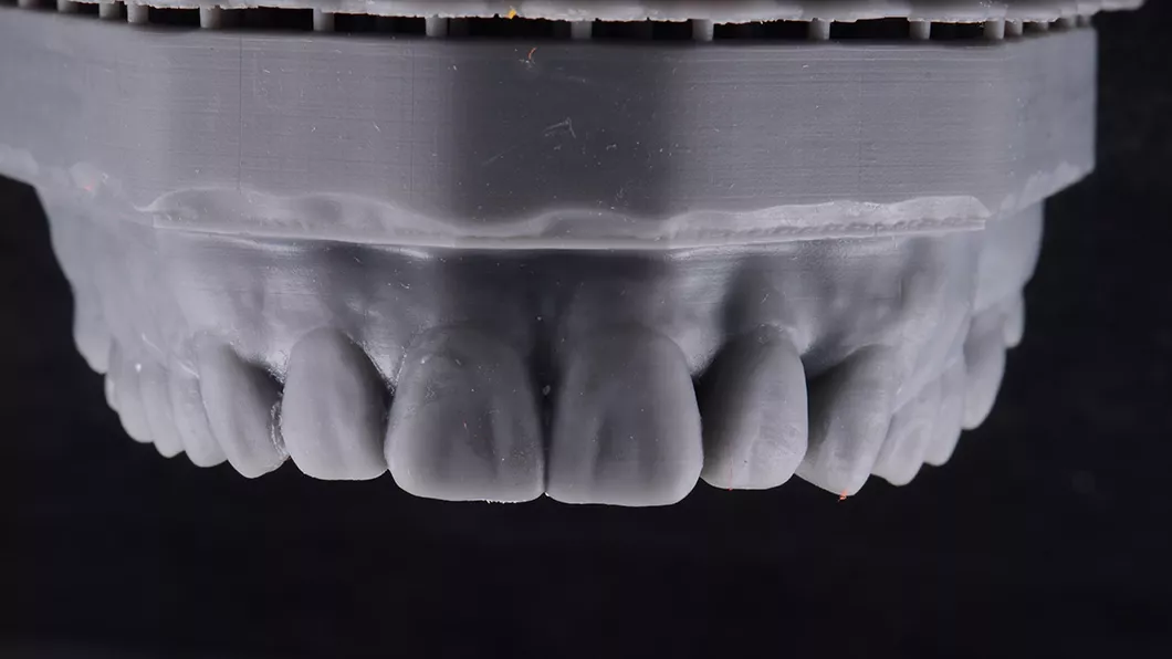 Моделирование и 3D&nbsp;печать модели с новой формой зубов. Изготовление силиконового ключа Фото 2