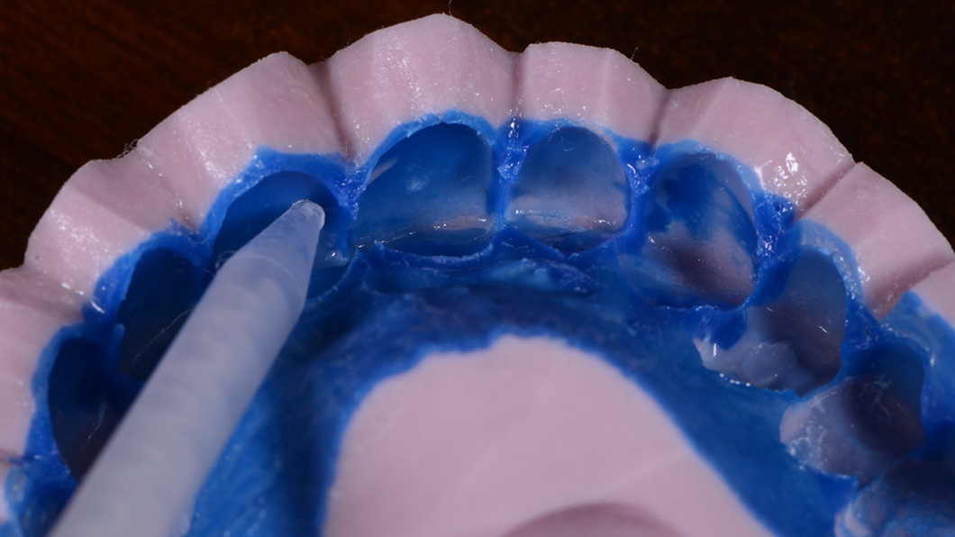 Моделирование и 3D печать модели с новой формой зубов. Изготовление силиконового ключа
