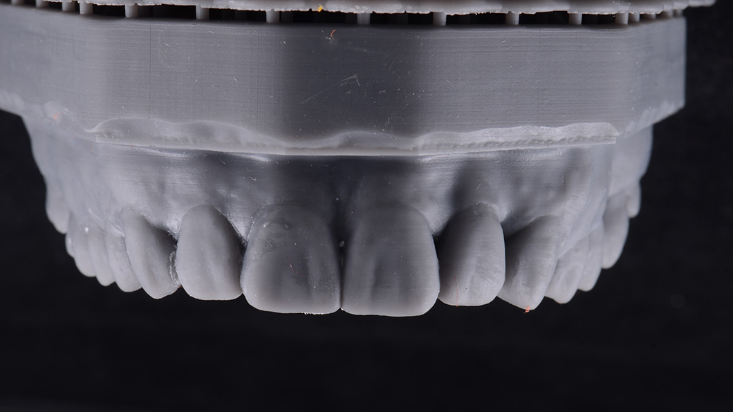 Моделирование и 3D печать модели с новой формой зубов. Изготовление силиконового ключа Фото 2
