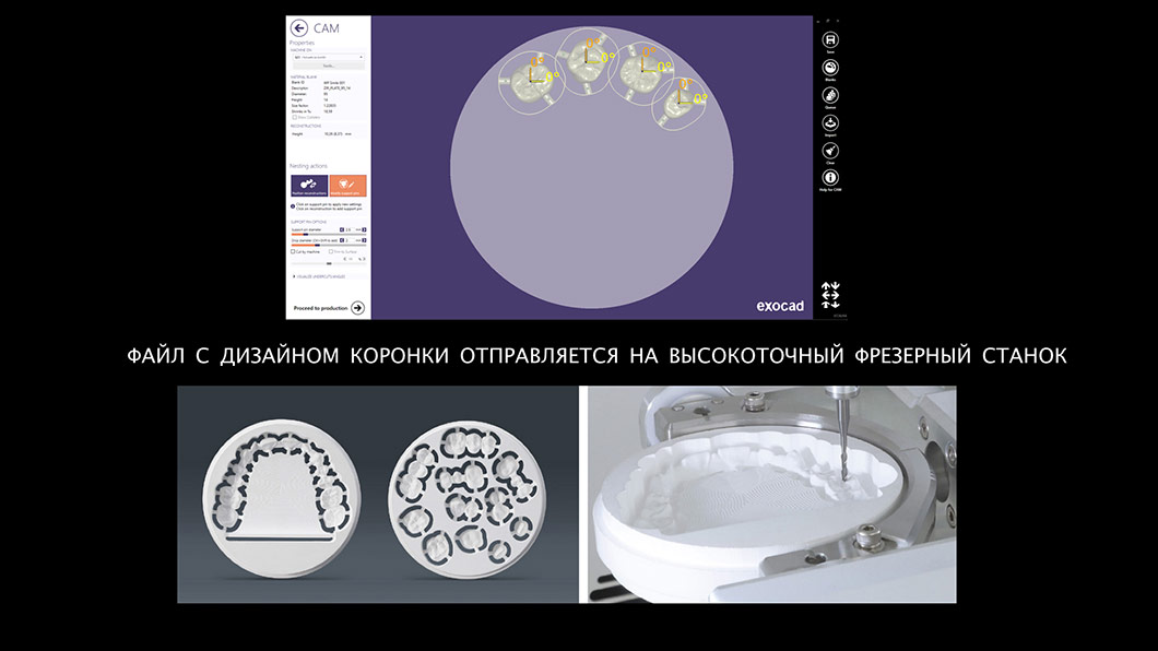 Полученная 3D-компьютерная модель коронки - Цифровая стоматология Киев Бровары